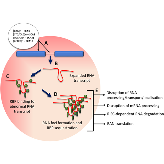SCA-3 (Spinocerebellar Ataxia): ATXN3 Gene Mutation